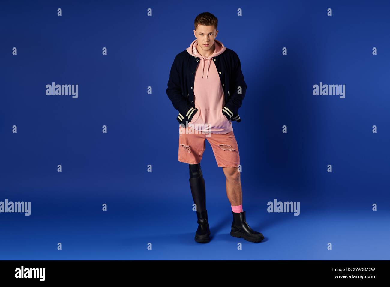 A young, attractive man stands tall wearing casual clothing, highlighting his prosthetic leg. Stock Photo