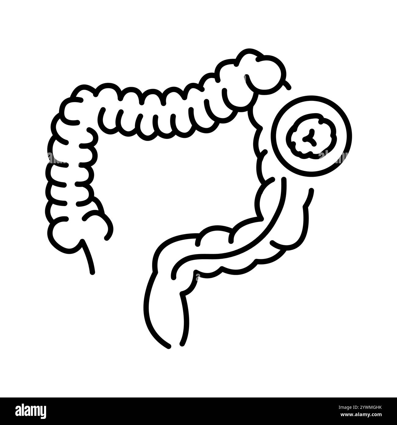 Colonotomy line black icon. Sign for web page, mobile app, button, logo. Vector isolated button. Editable stroke. Stock Vector