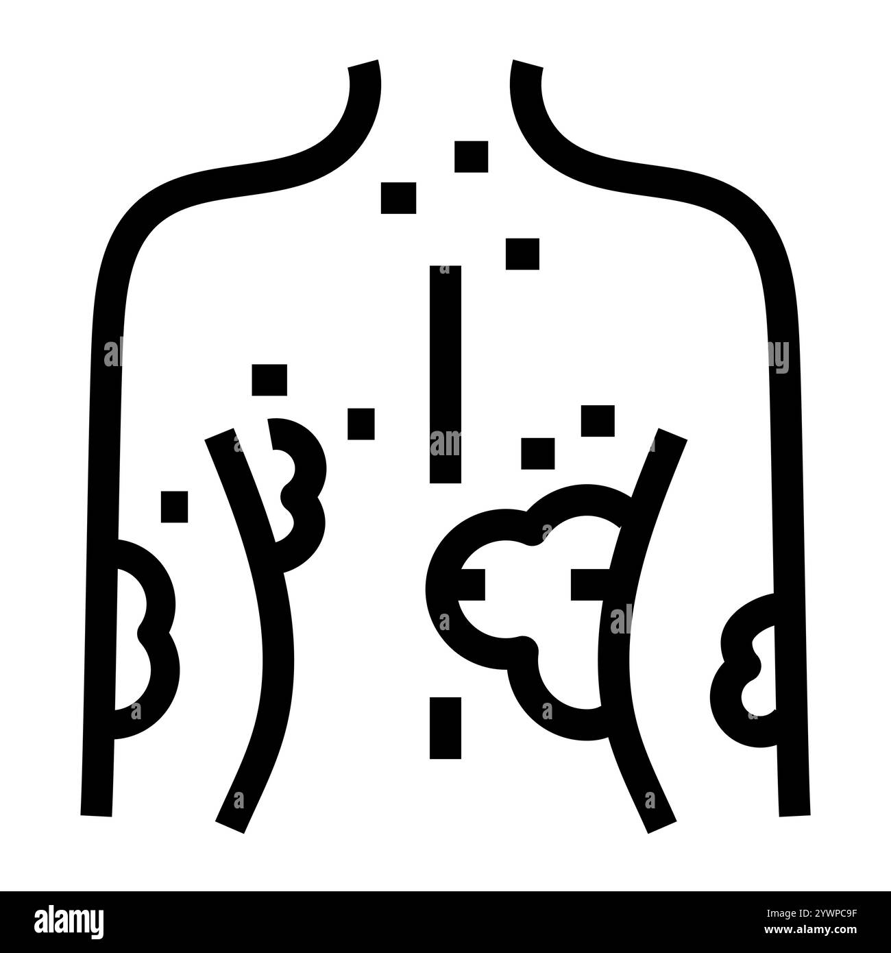 Psoriasis line black icon. Vector isolated button. Editable stroke. Stock Vector