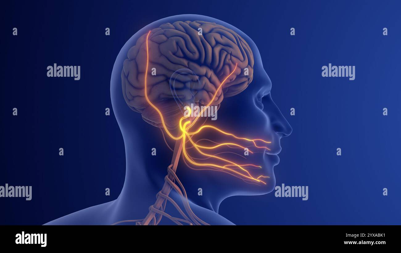 Trigeminal Neuralgia Causing Severe Facial Nerve Pain Stock Photo - Alamy