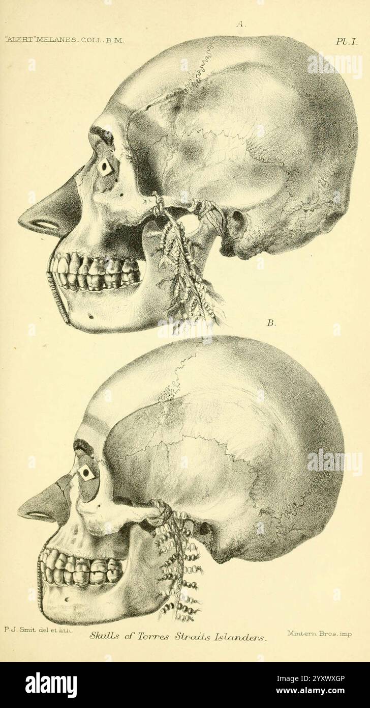 Report, on, the, zoological, collections, made, in, the, Indo-Pacific, Ocean, during, the, voyage of H.M.S, 'Alert', 1881-2. London, 1884, alerts, loop, 1856, 1895, Australia, islands, of, the, Indian, Ocean, Melanesia, scientific, expeditions, zoology, skull, skulls, of, torres, straits, islanders, torres, straits, human, human, crania, Pierre, Jacques, Smit, 8, homo, sapiens, pin, page, rights, This illustration presents a detailed anatomical study of the human skull, featuring a side view of two outlined skulls labeled A and B. The image highlights the structural differences in the cranial Stock Photo