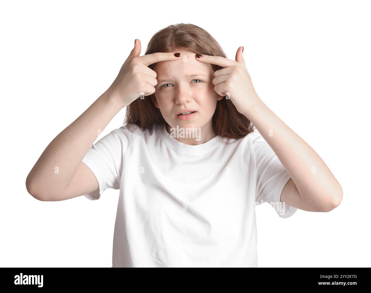 Teenage girl popping pimple on her face against white background. Acne problem Stock Photo