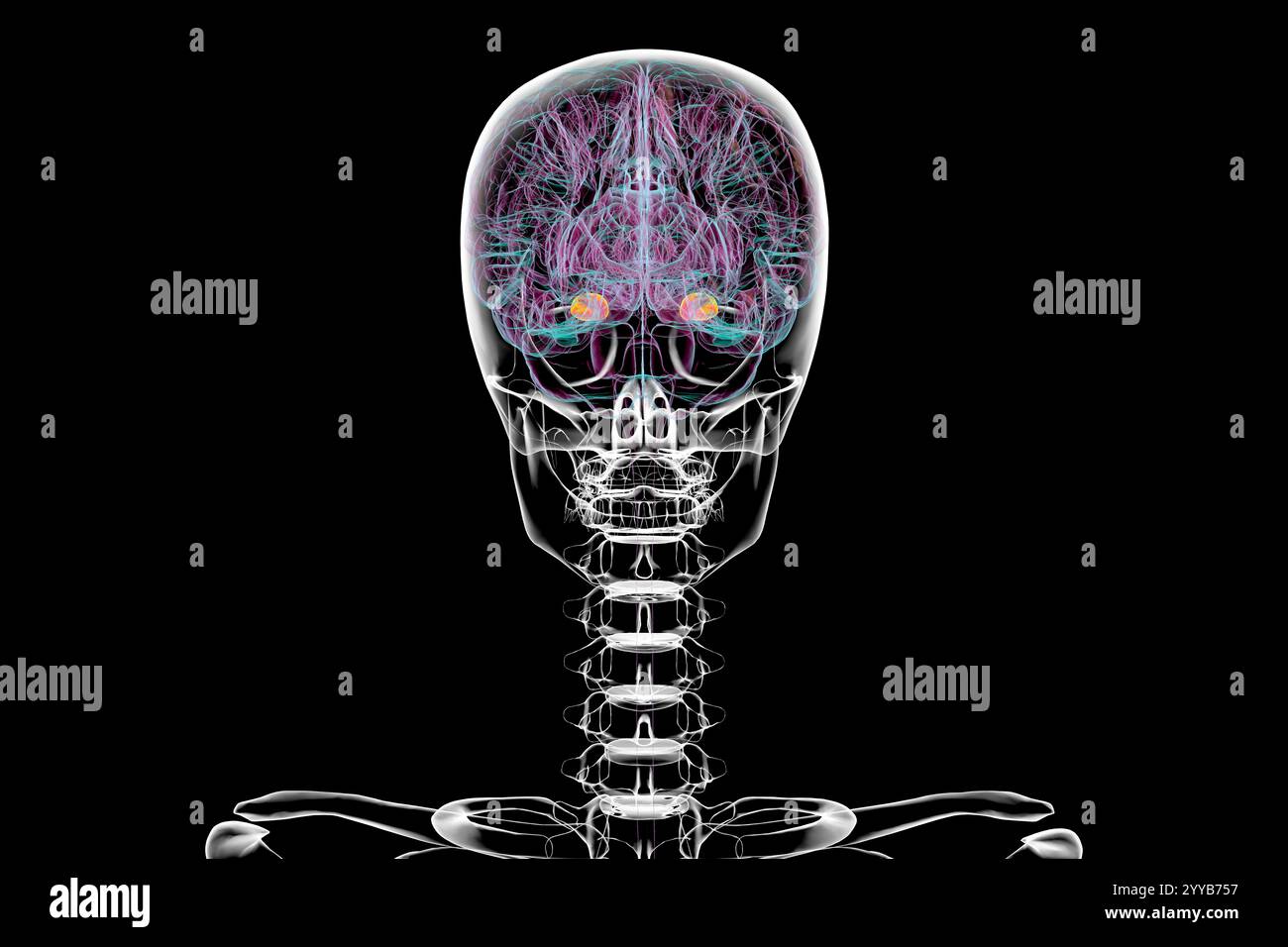 Human brain with the amygdala highlighted, computer illustration Stock ...
