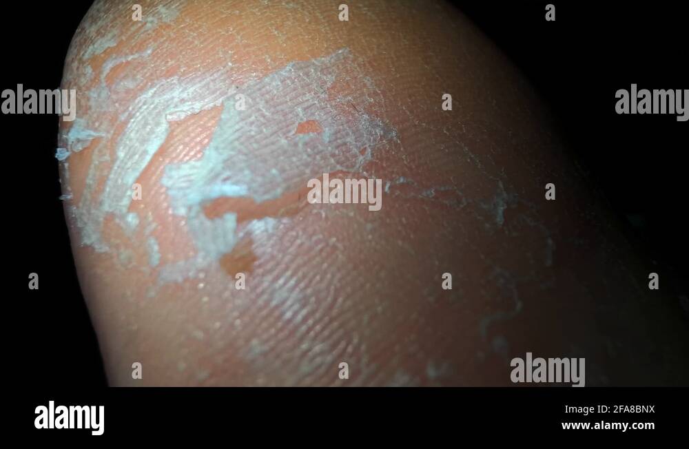 Exfoliation Stock Videos & Footage HD and 4K Video Clips Alamy