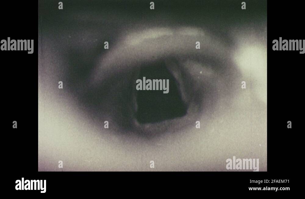 Vocal cords and larynx Stock Videos & Footage HD and 4K Video Clips