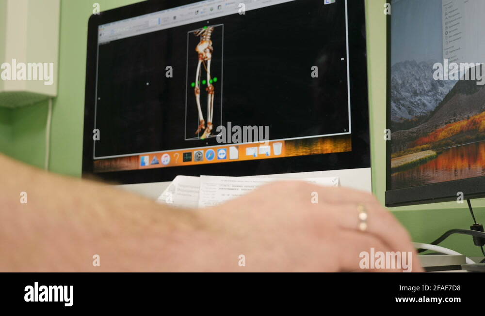 Ct mri brain scan Stock Videos & Footage - HD and 4K Video Clips - Alamy
