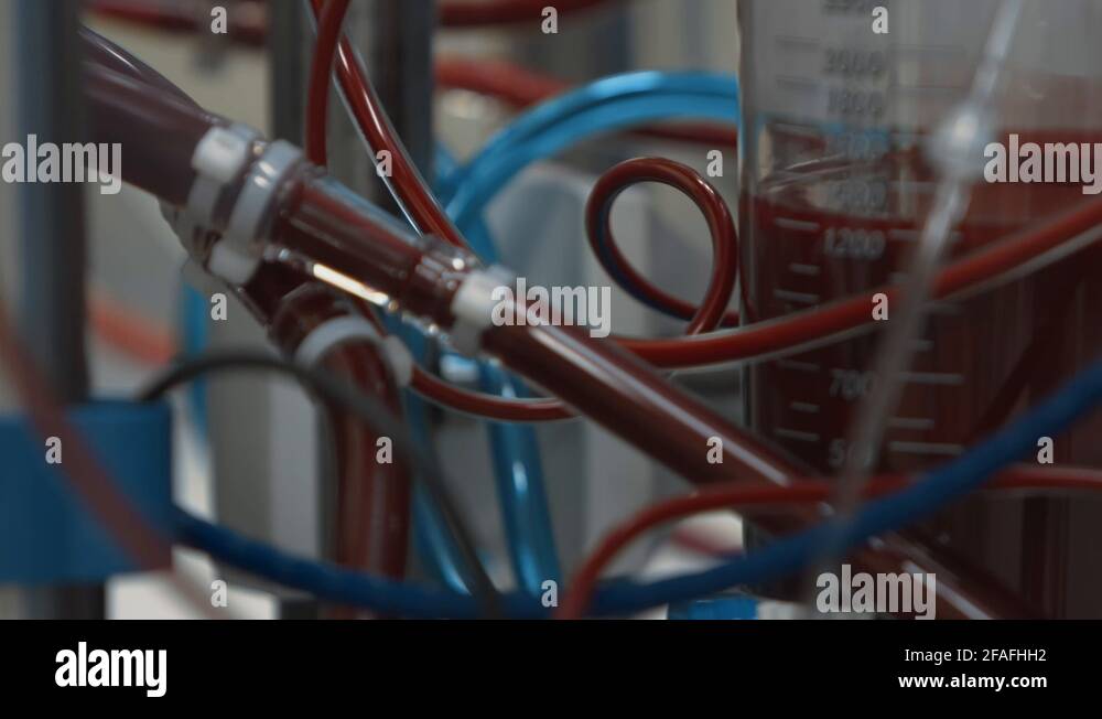 Plastic tubes with circulating blood during medical operation. Blood