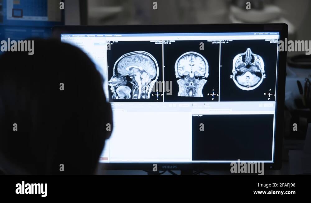 MRI head scan process. High tech Medical Screens with results of Brain