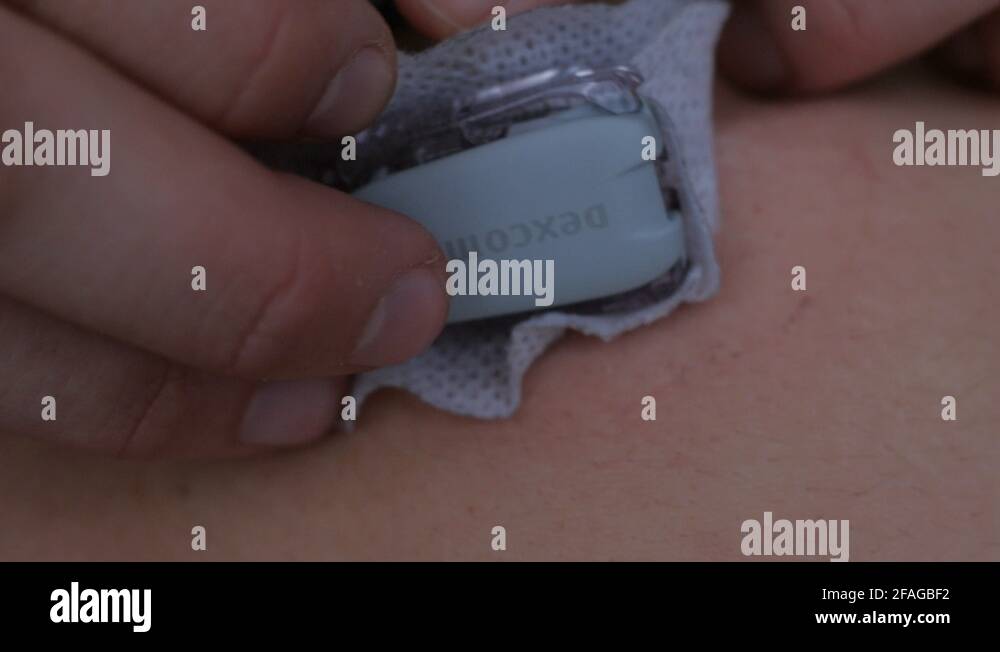 dettaching. removing transmitter, realtime glucose reading