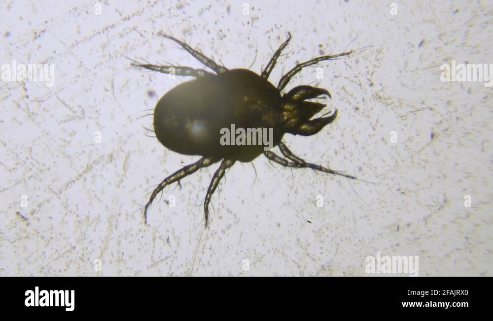 Bed bug microscope Stock Videos & Footage HD and 4K Video Clips Alamy