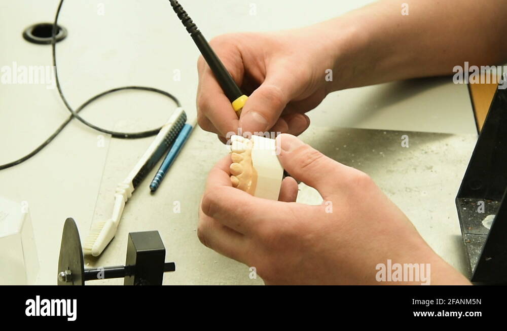 Implant dental Stock Videos & Footage - HD and 4K Video Clips - Alamy