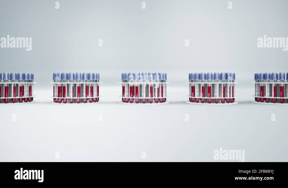 Vacutainer holders Stock Videos & Footage - HD and 4K Video Clips - Alamy