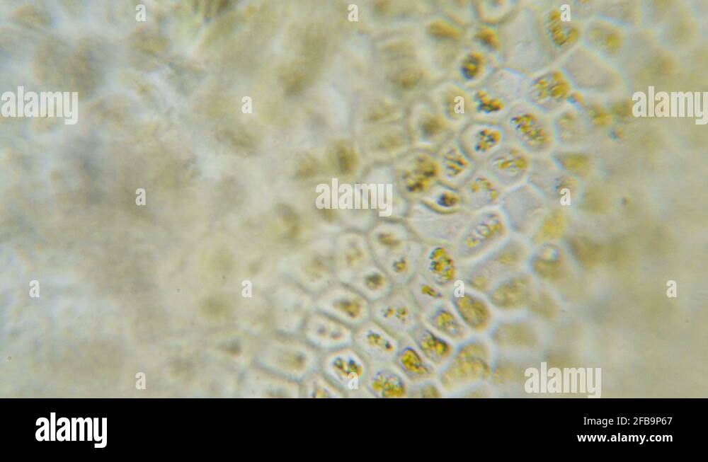 Chloroplast under a microscope. Chloroplasts in plant cells. Cell