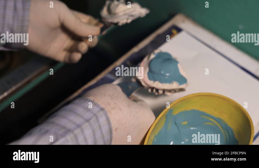 Pouring of mixed dental stone to the impression for making the Cast in