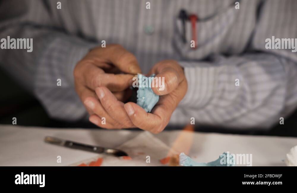 Finishing touch to a dental occlusion cast mold using a burner, close
