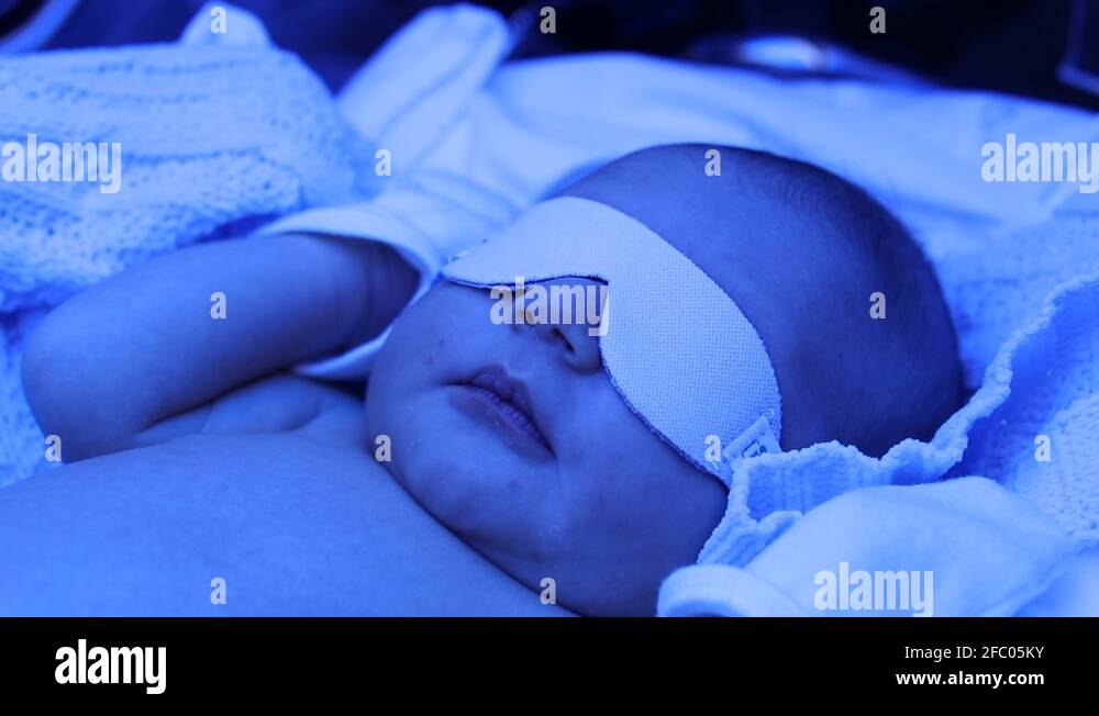 Newborn jaundice baby Stock Videos & Footage HD and 4K Video Clips