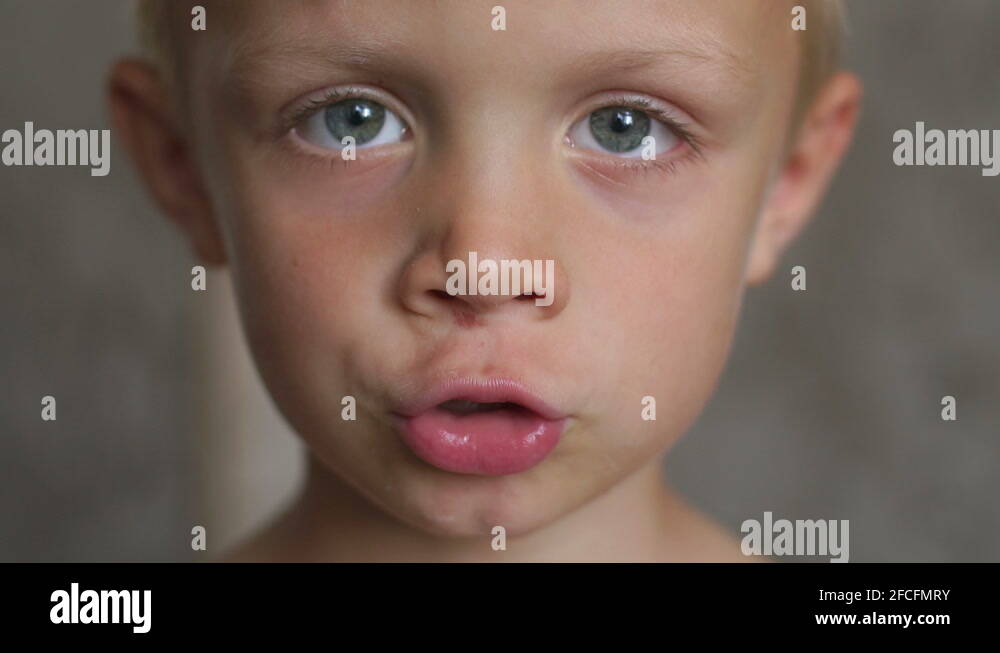 Nose bleed child Stock Videos & Footage HD and 4K Video Clips Alamy