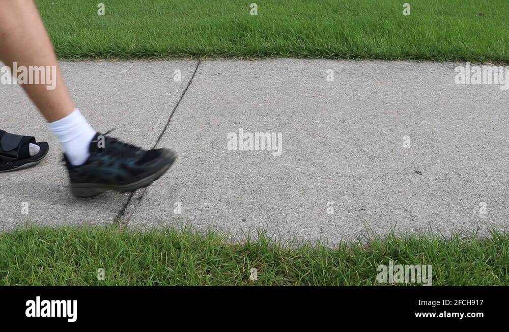 Broken foot cast boot Stock Videos & Footage HD and 4K Video Clips