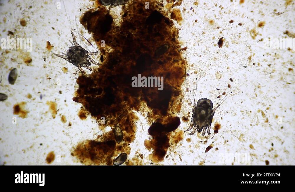 Ear Mite Under Microscope Stock Video Footage Alamy 