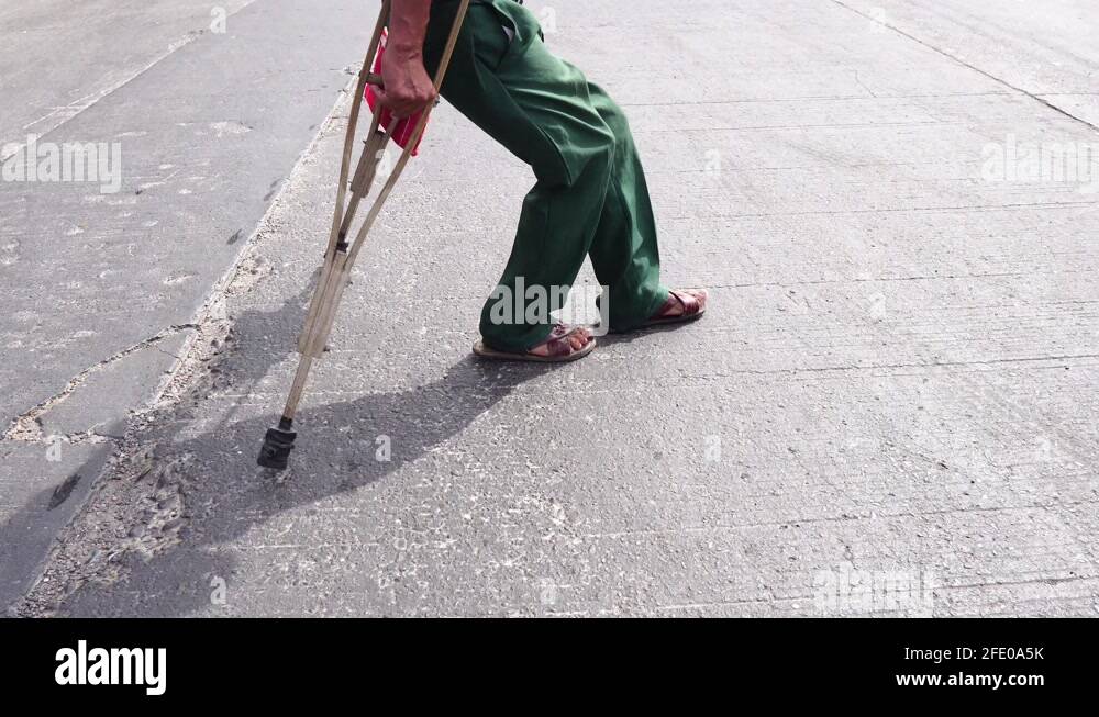 Man crutches expression Stock Videos & Footage HD and 4K Video Clips