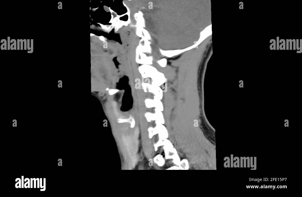 Appendicitis scan Stock Videos & Footage - HD and 4K Video Clips - Alamy