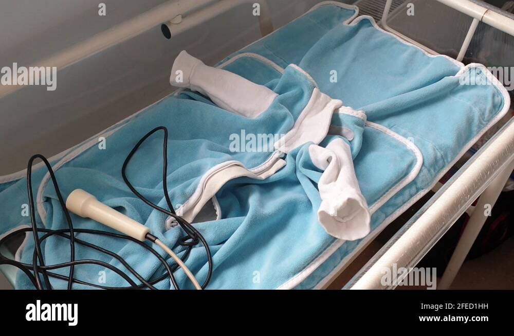 Newborn jaundice Stock Videos & Footage HD and 4K Video Clips Alamy