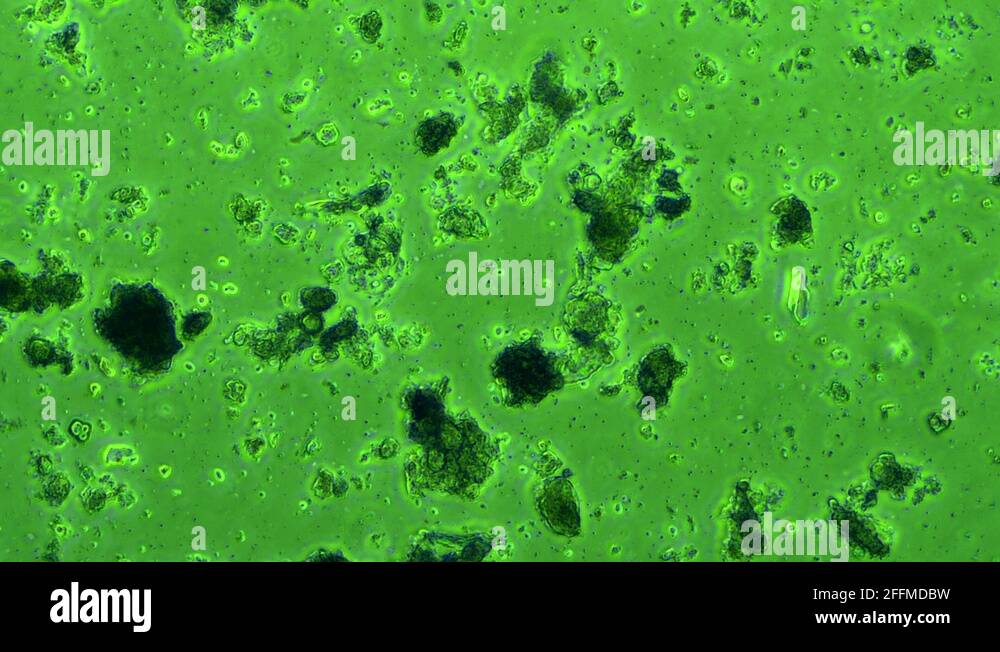 Mouth Plaque Bacteria phase microscope 600x Stock Video Footage Alamy