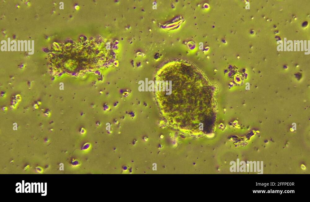 Dental Plaque Bacteria from human mouth microscope 600x Stock Video