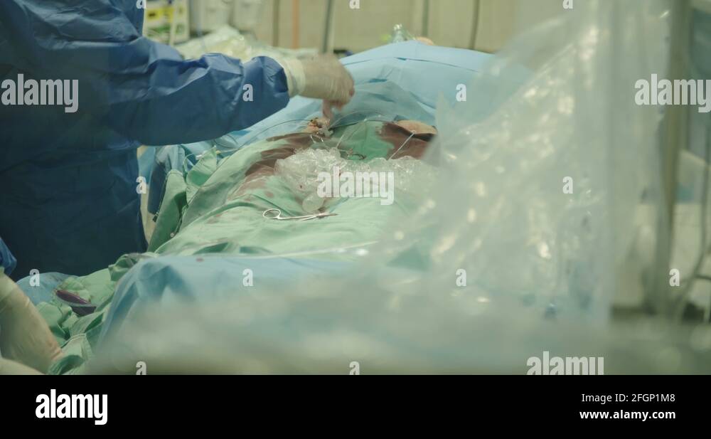 Cardiac catheterization lab Stock Videos & Footage HD and 4K Video