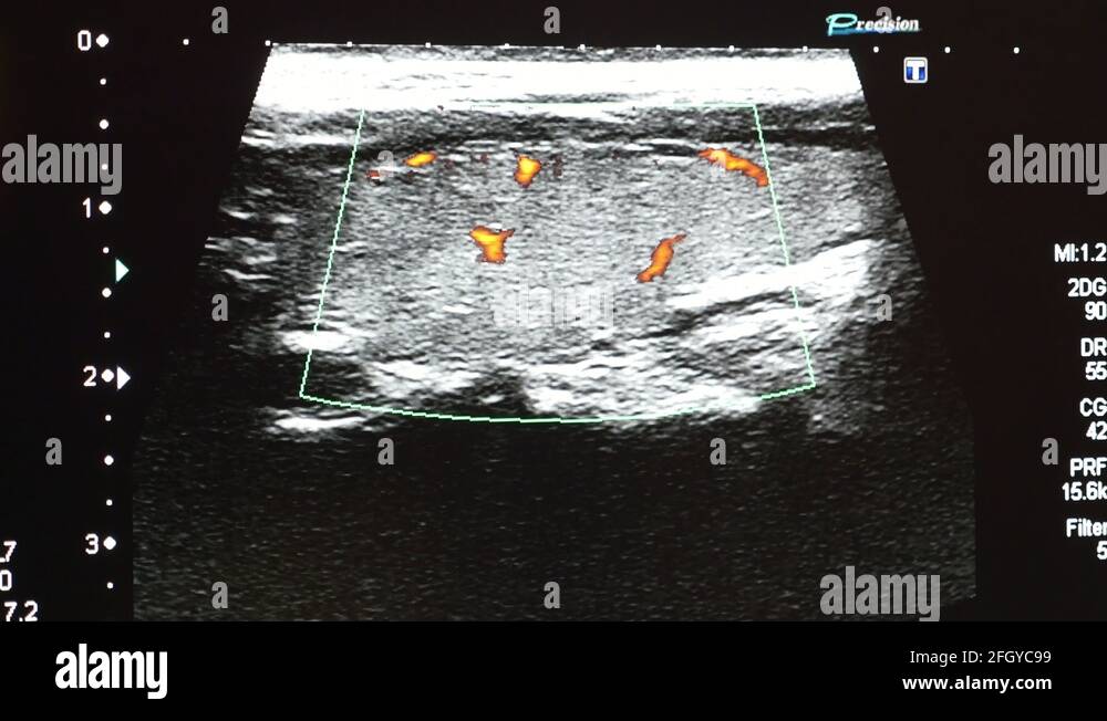 Radiogram black and white Stock Videos & Footage - HD and 4K Video ...