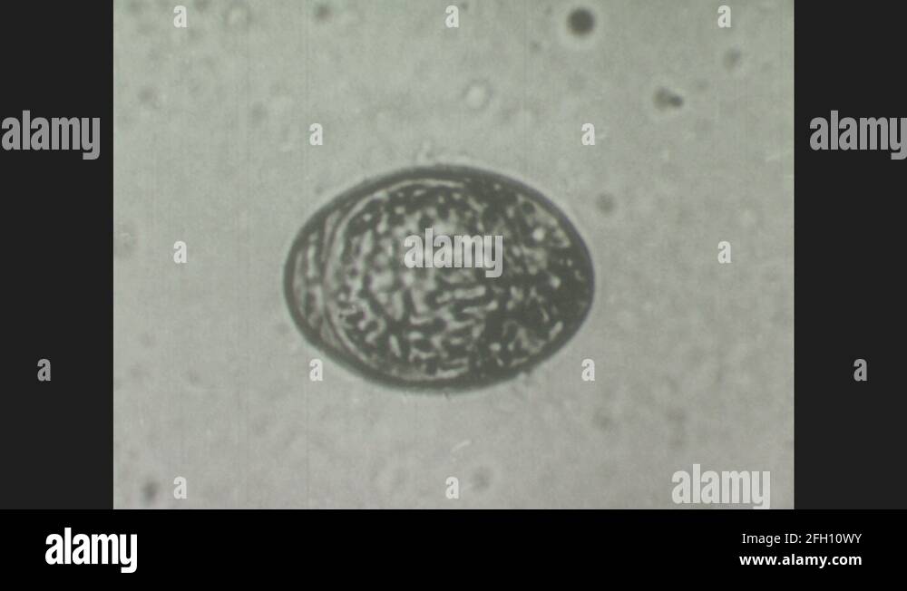 1940s Tapeworm egg under microscope hatches, operculum opens, embryo