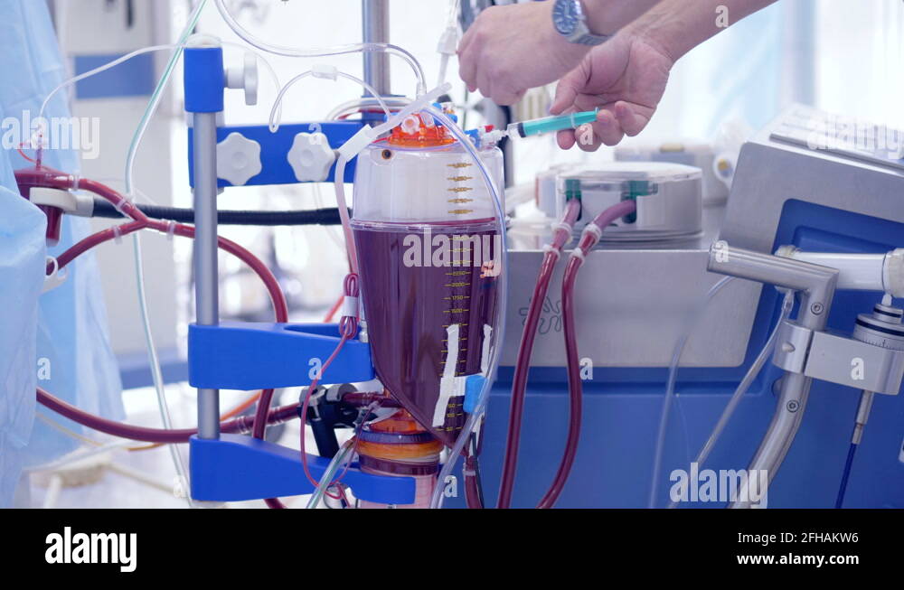 Dialysis Medical Device Performing Procedure during surgery. 4K Stock Video Footage Alamy