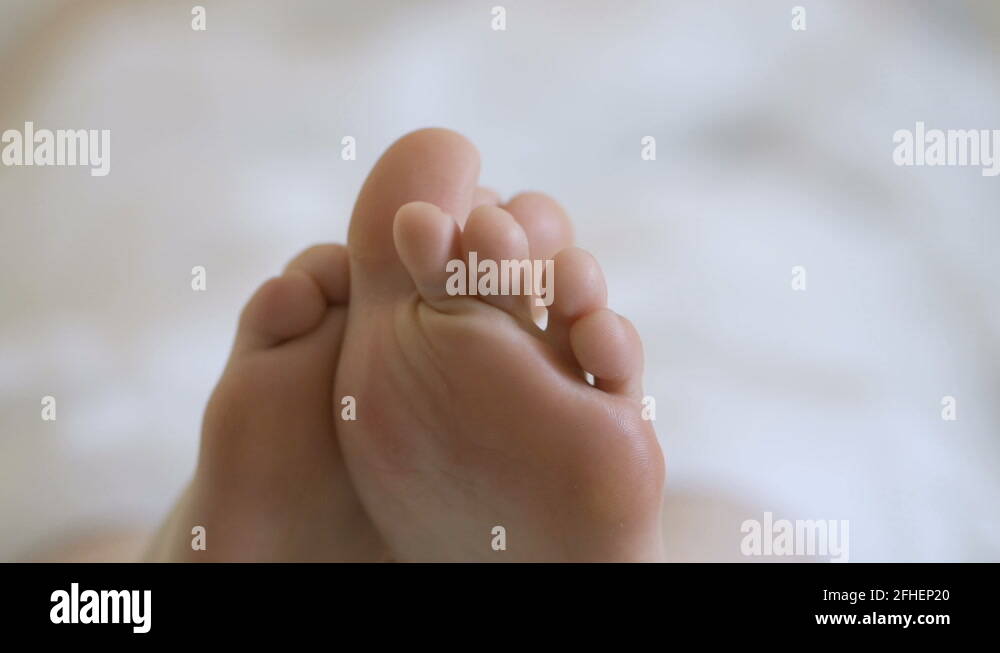Female feet with skin peeling off. Foot peeling after the procedure