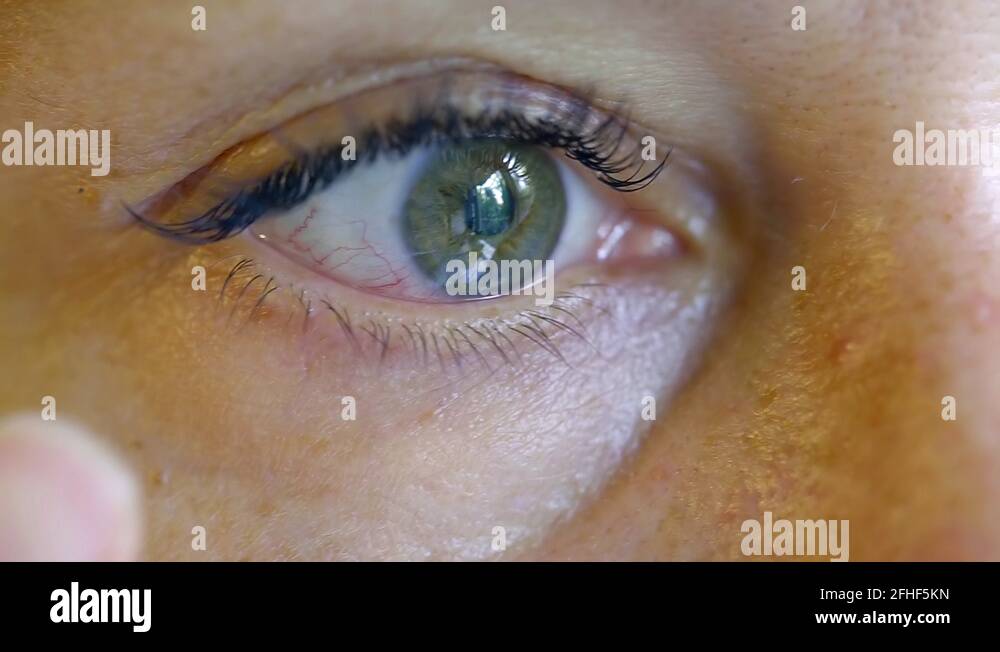 Eyelash glue Stock Videos & Footage HD and 4K Video Clips Alamy