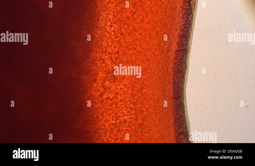 Normal anemia red blood cell Stock Videos & Footage HD and 4K Video