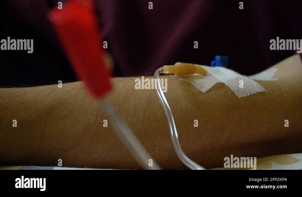 Intravenous injection. Infusion of the drug into a vein through an IV