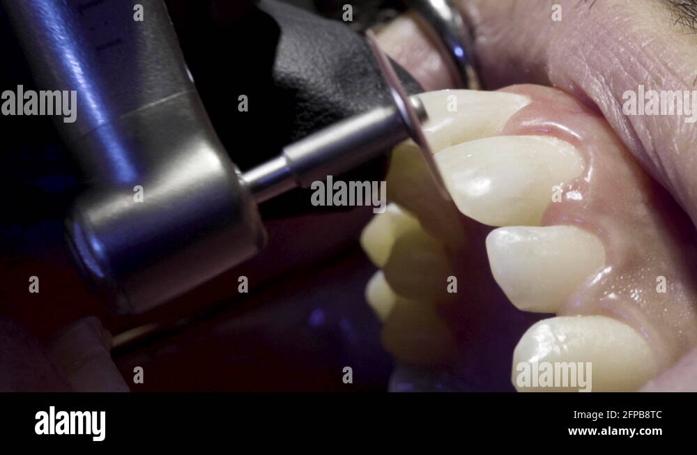 Oral disk Stock Videos & Footage HD and 4K Video Clips Alamy