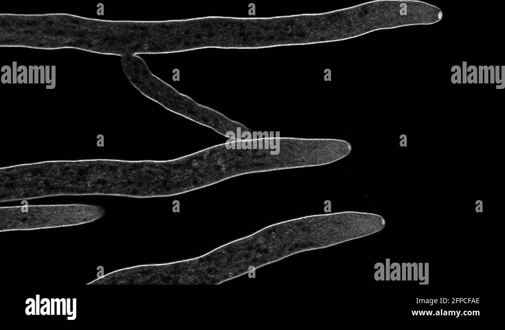 Hyphae growing like a network of arteries. Neurospora crassa stained