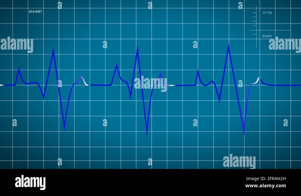 Depicted movement Stock Videos & Footage HD and 4K Video Clips Alamy