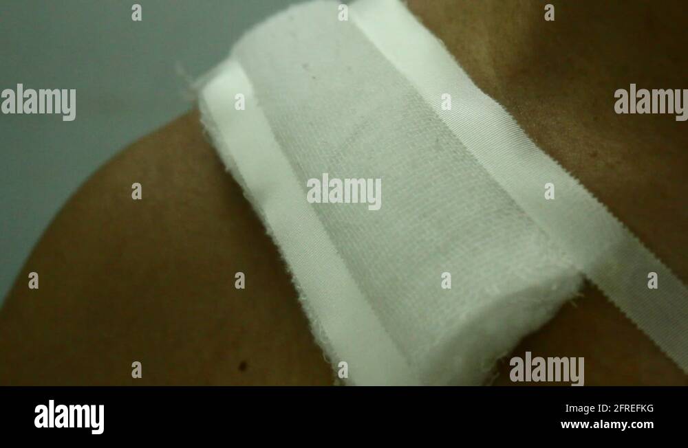 Wash and cut the sutures wounds Stock Video Footage Alamy