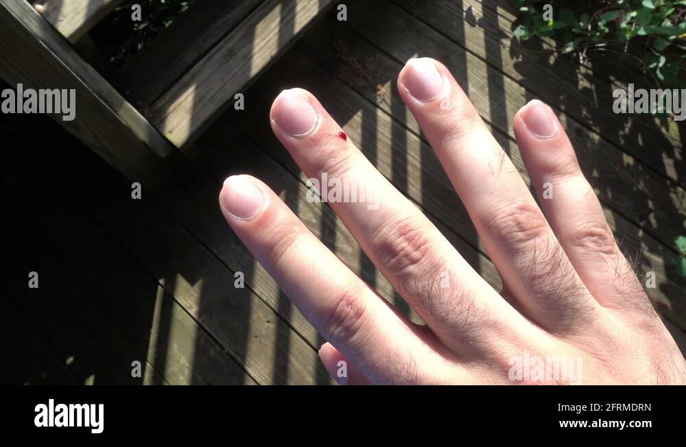 Bleed bleeding Stock Videos & Footage HD and 4K Video Clips Alamy