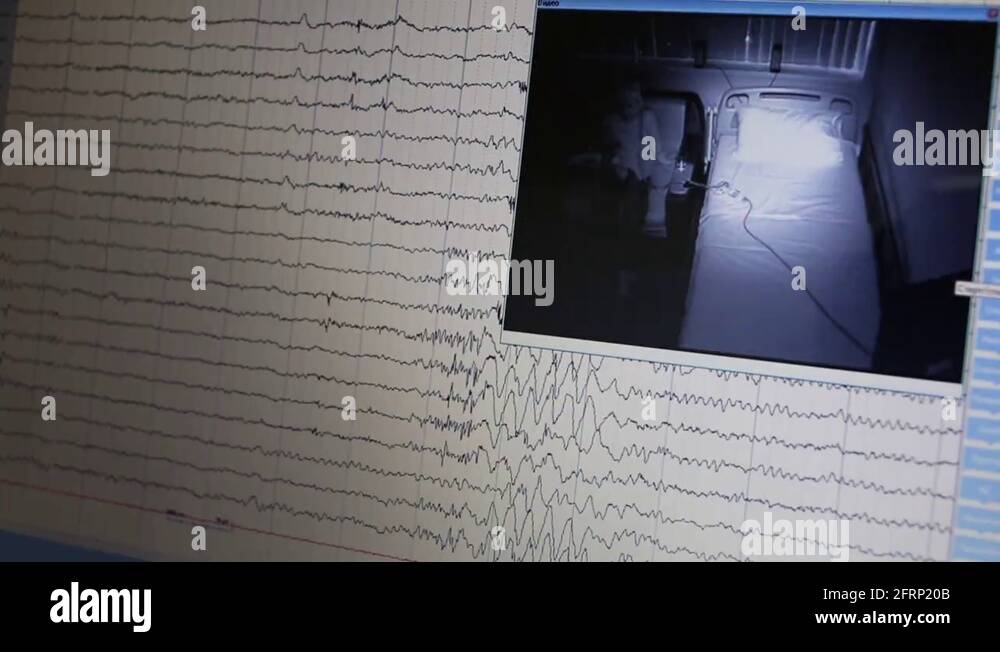 Monitor EEG graph with a view room with girl and flashes of light Stock