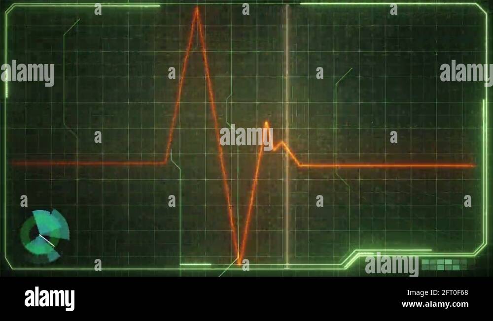 Heart rate curve Stock Videos & Footage HD and 4K Video Clips Alamy