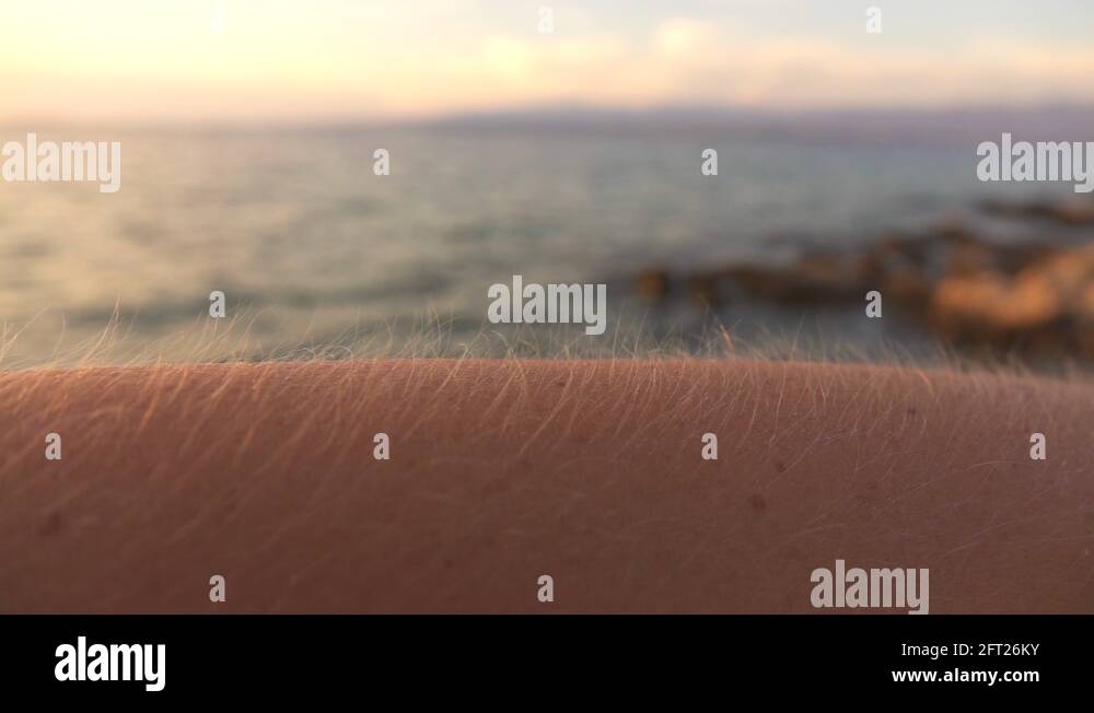 MACRO: Goosebumps on human skin on beautiful cold summer evening before ...