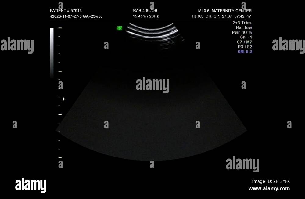 Baby scan pregnancy test Stock Videos & Footage HD and 4K Video Clips