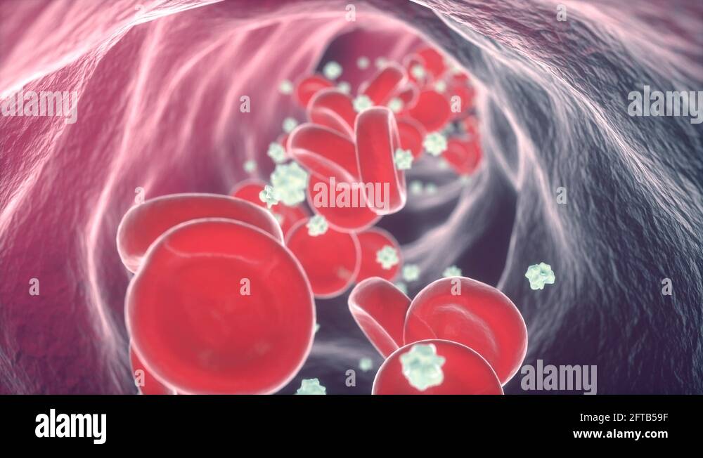 Blood clot vein Stock Videos & Footage HD and 4K Video Clips Alamy