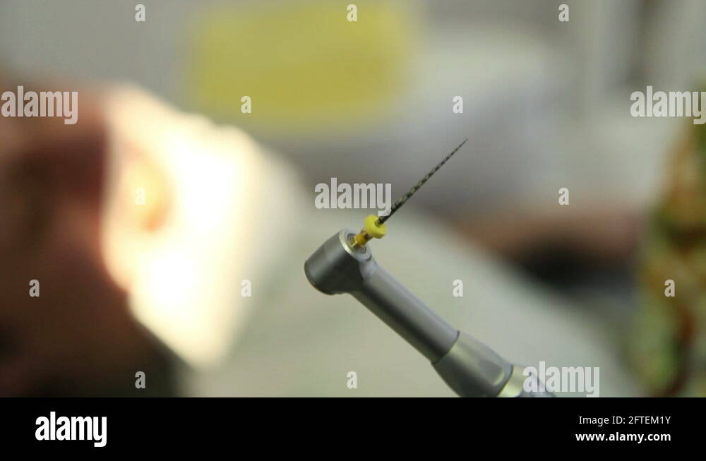 Dental drill turbine Stock Videos & Footage HD and 4K Video Clips Alamy