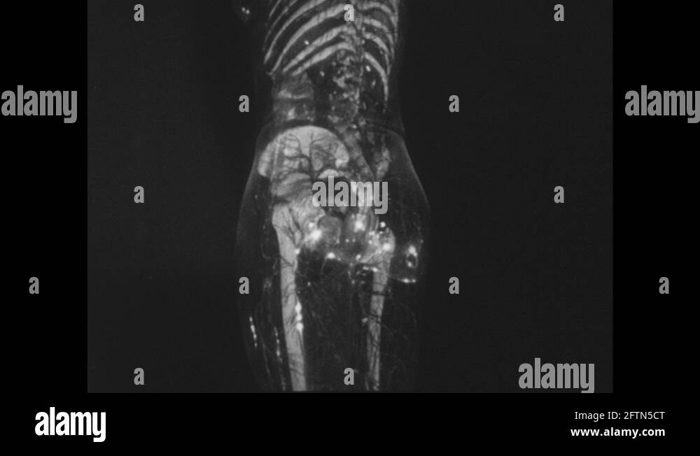 Girdle Stock Videos & Footage HD and 4K Video Clips Alamy