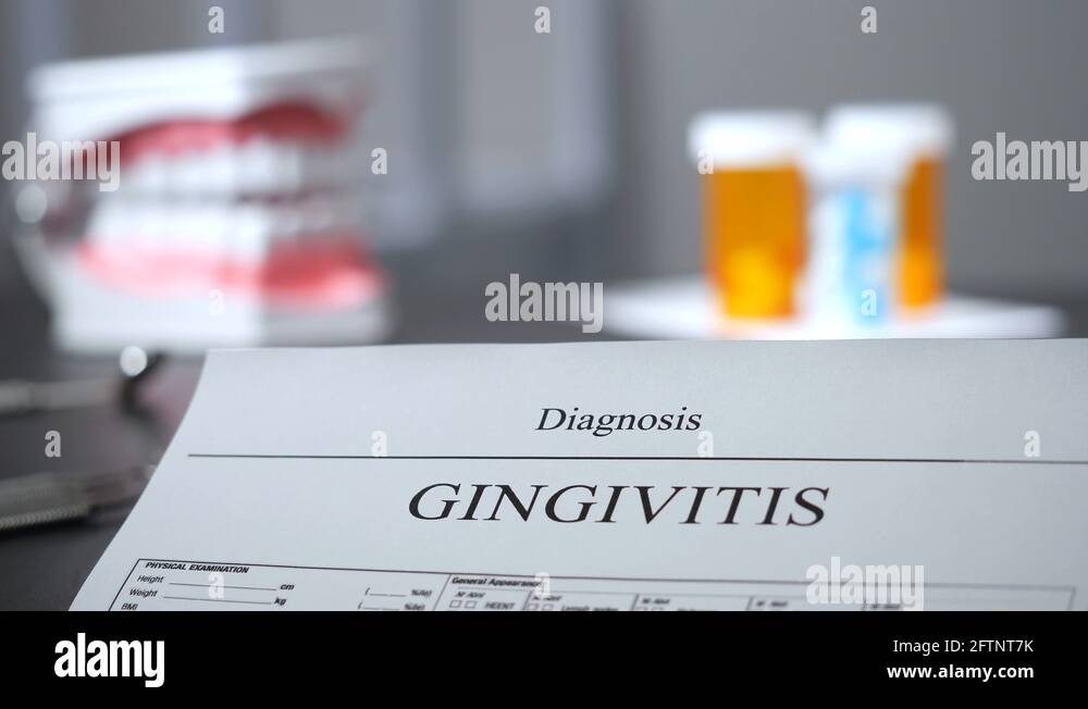 Gingivitis therapy Stock Videos & Footage HD and 4K Video Clips Alamy