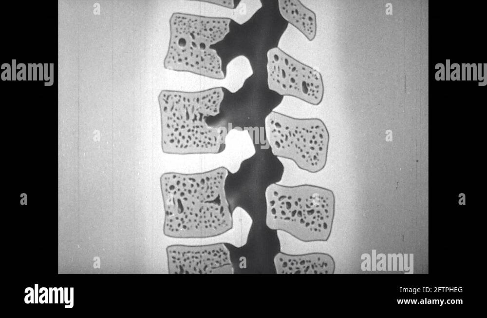 Spinal canal Stock Videos & Footage - HD and 4K Video Clips - Alamy